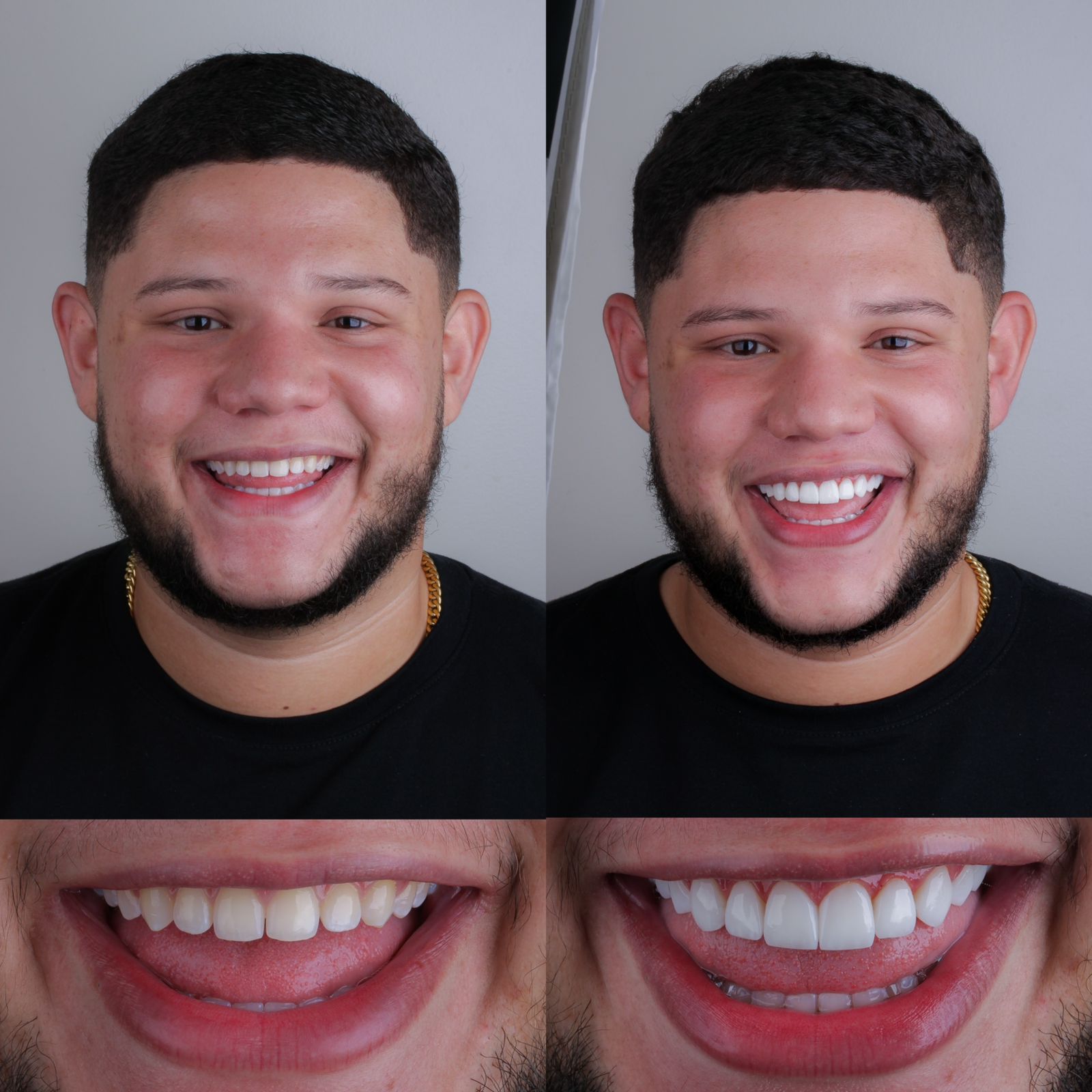 Caso GOU 18